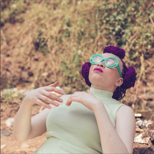 \'I was reading an article about the atrocities that were happening to people with albinism in Tanzania and it shocked me.\' \'I was reading an article about the atrocities that were happening to people with albinism in Tanzania and it shocked me.\'