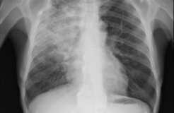 7471755378_bd41950011_o 7471755378_bd41950011_o