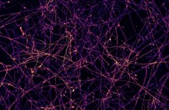 Credit-Victor-Caldas_Caption-High-resolution mycelium network 2