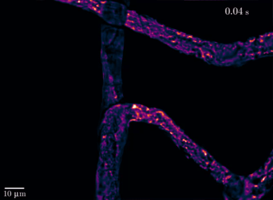 ezgif-2-bc55a7c53a25