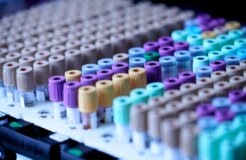 testalize-me-0jE8ynV4mis-unsplash