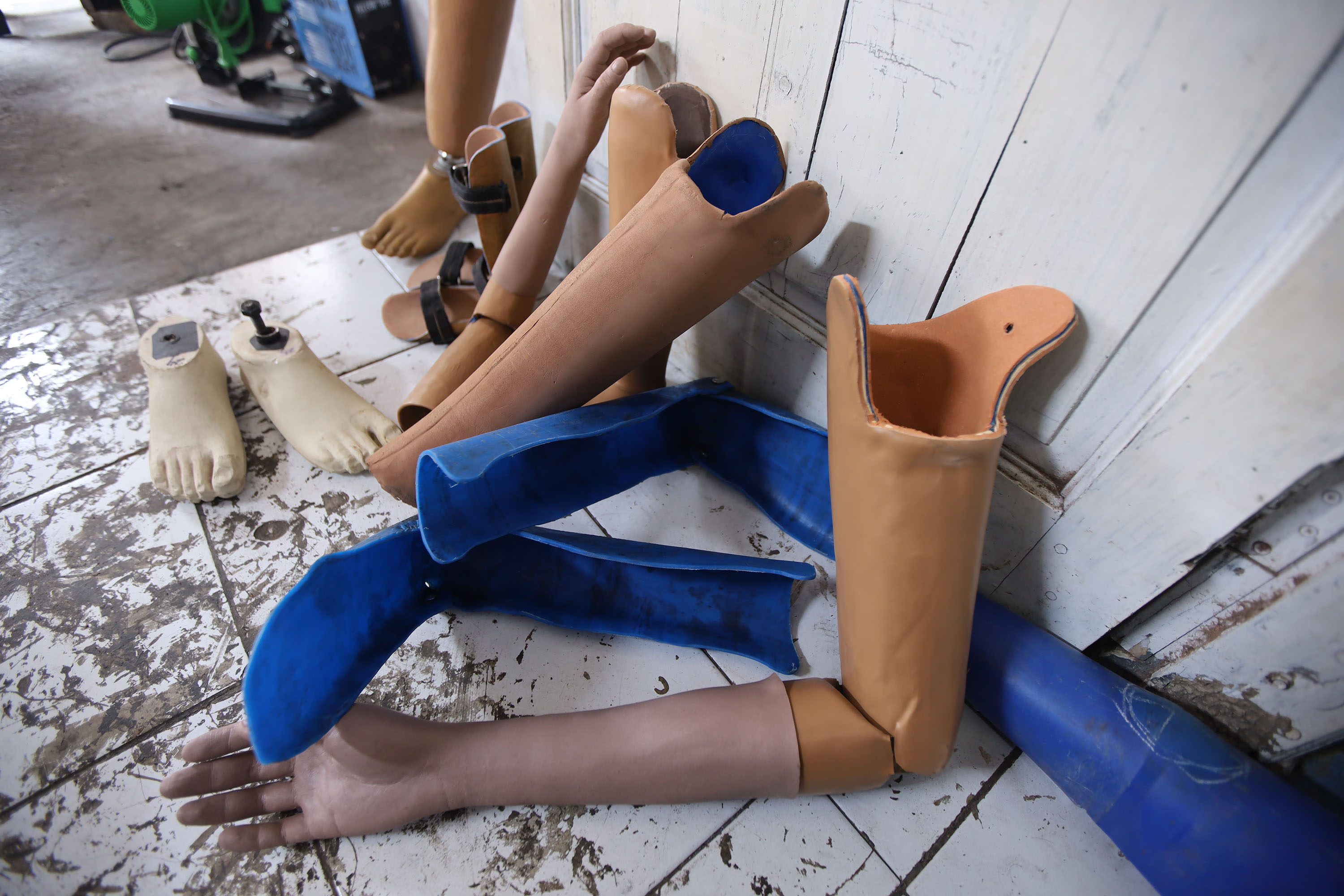 These prosthetic legs and arms are affordable for low-income disabled people.