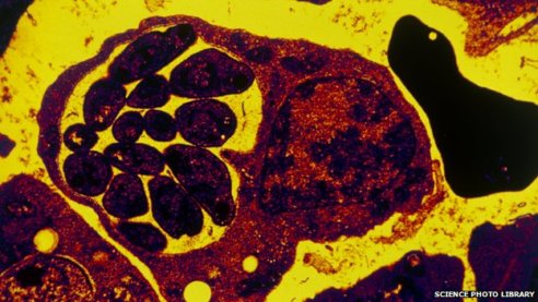 blood cell with malaria parasites