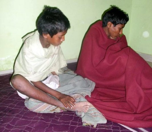 12-year-old Sumit and his 11-year-old brother Amit were traded in August 2014 by their father to a shepherd of Rajasthan named Bhura.