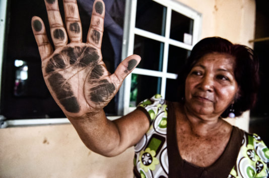 Elena Riquer shows her hand blackened after passing it over her home\'s window.