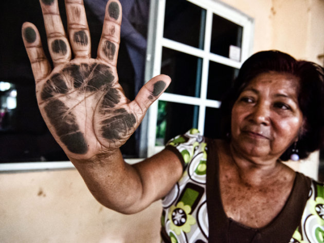 Elena Riquer shows her hand blackened after passing it over her home\'s window. Elena Riquer shows her hand blackened after passing it over her home\'s window.