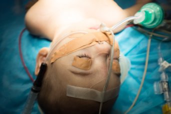child in heart surgery child in heart surgery
