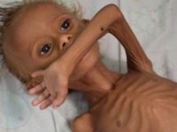 Yemen_Hunger crisis Yemen_Hunger crisis