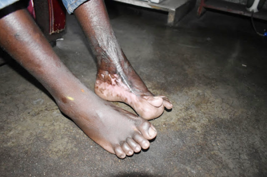 Disabled... Obedient Dube's feet