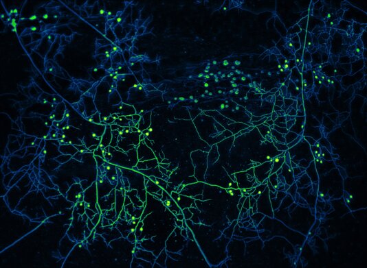 Credit-Loreto-Oyarte-Galvez_Caption-High-resolution mycelium network 1