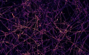 Credit-Victor-Caldas_Caption-High-resolution mycelium network 2