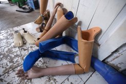 These prosthetic legs and arms are affordable for low-income disabled people.